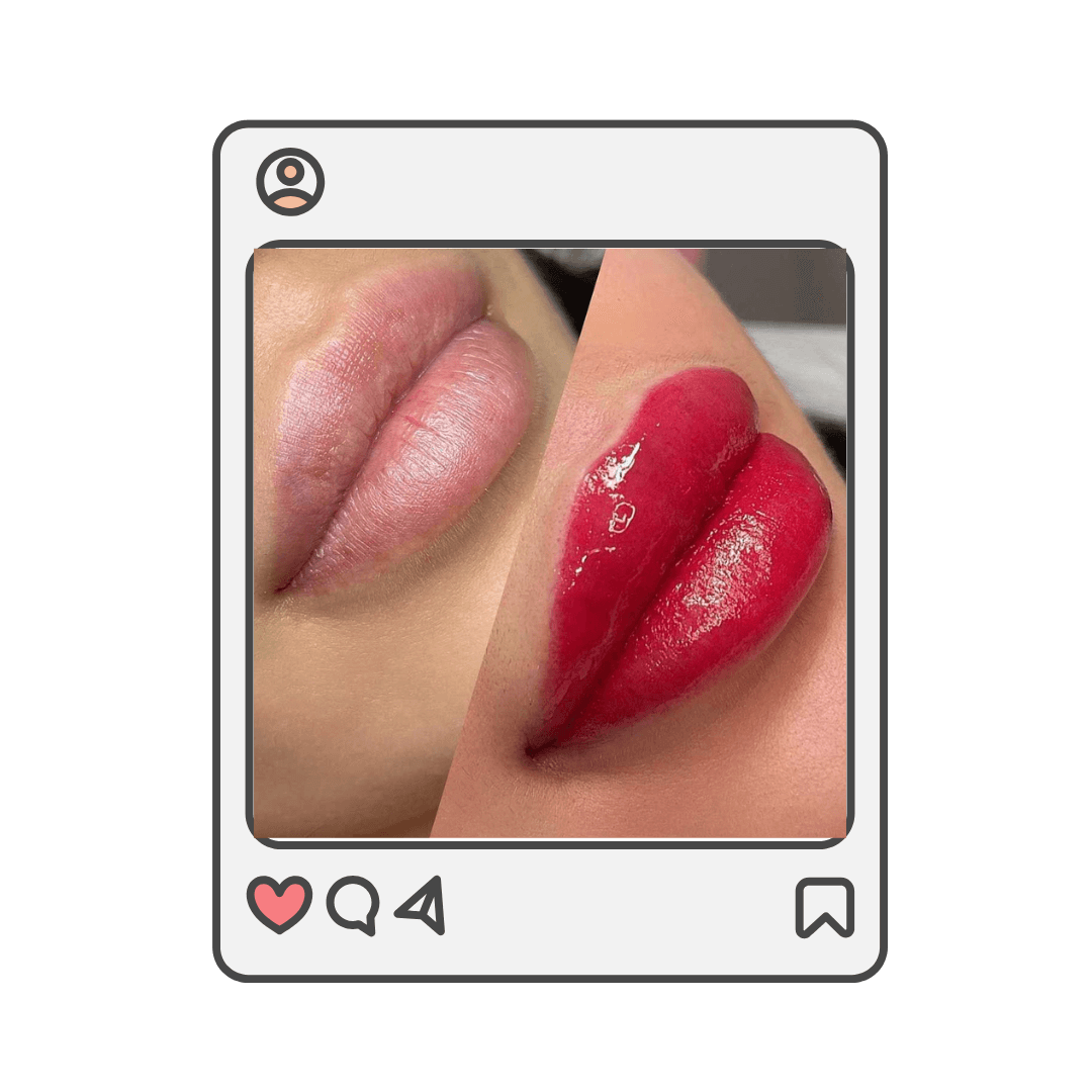 NEUTRALIZACION DE LABIOS (1) (1)